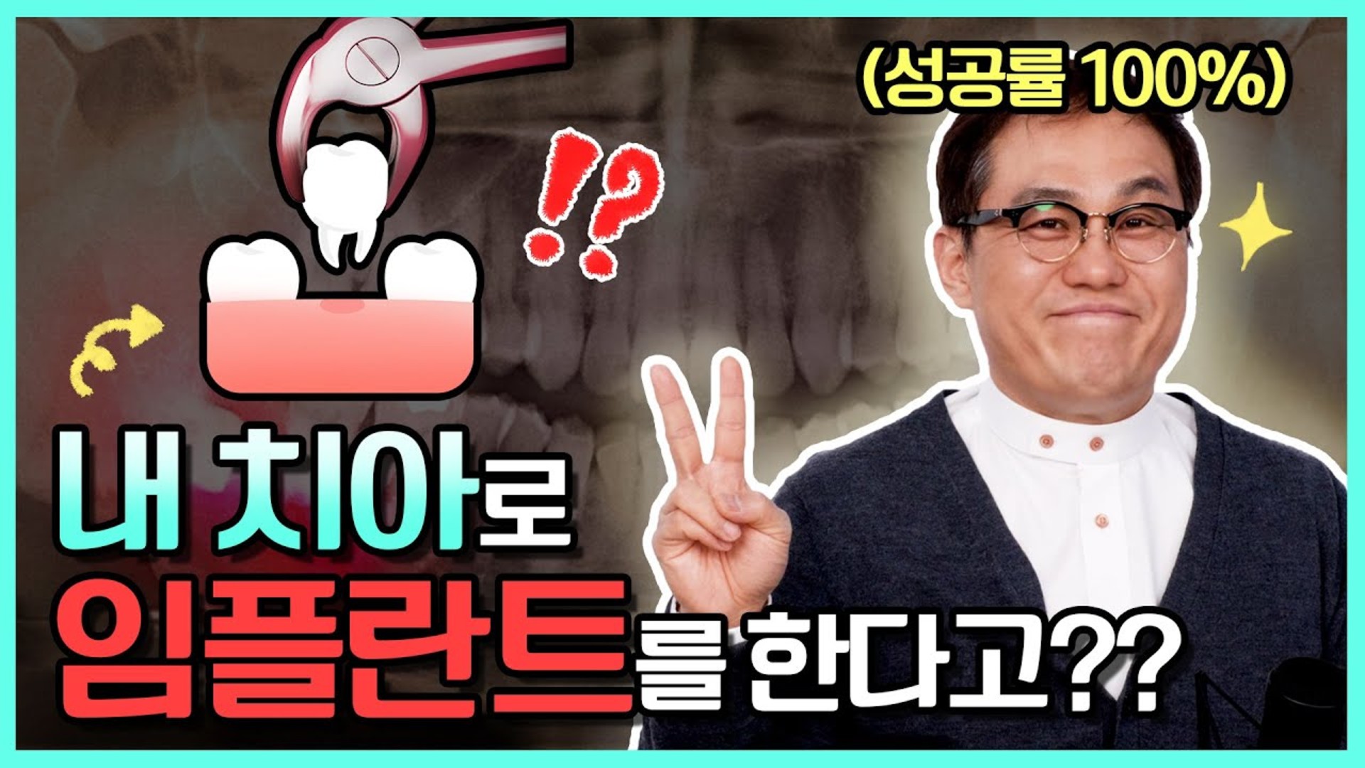 내 치아를 이용하는 자가치아이식 영상 썸네일