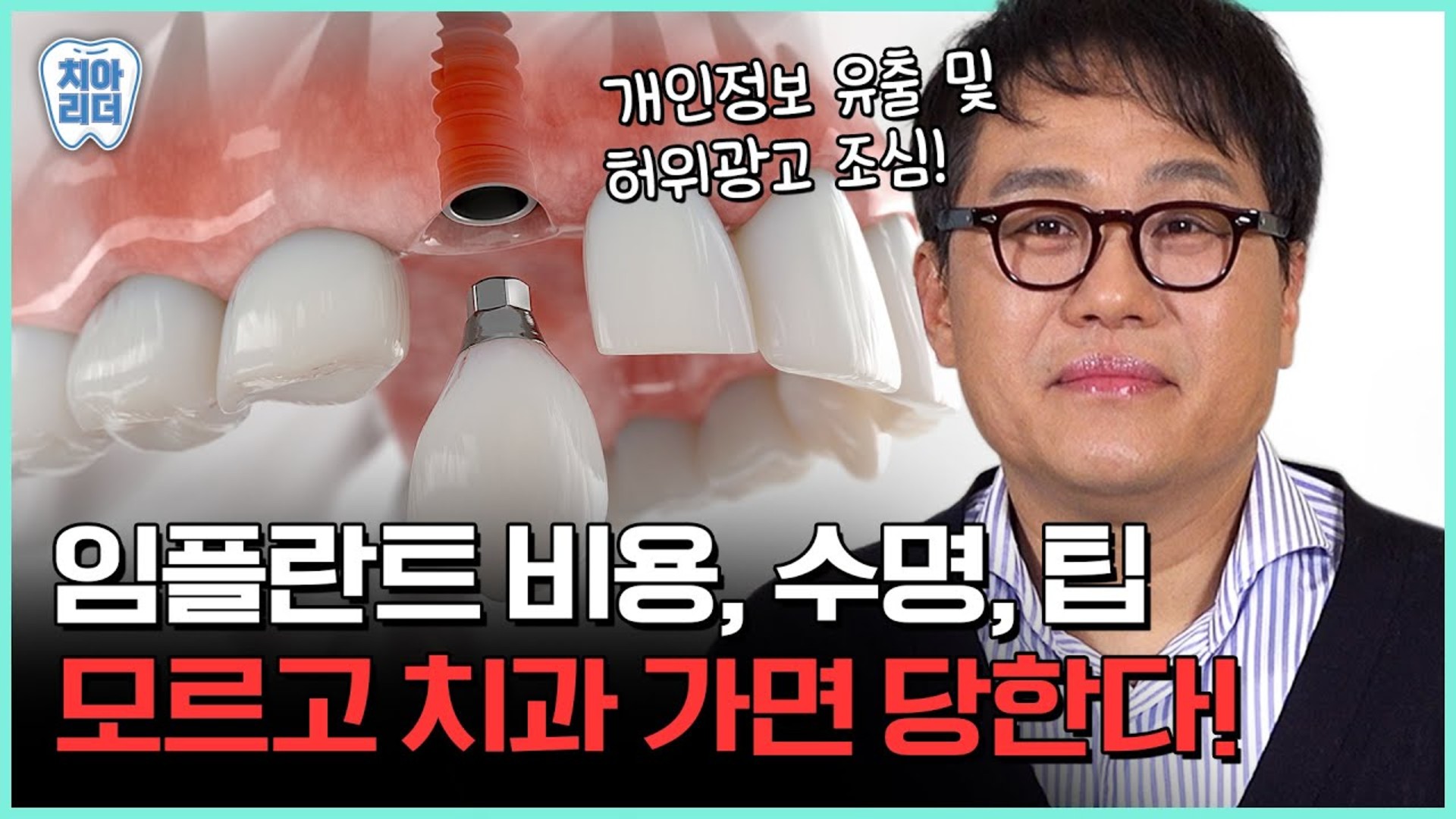 임플란트 병원 선택 전 꼭 확인할 점 영상 썸네일